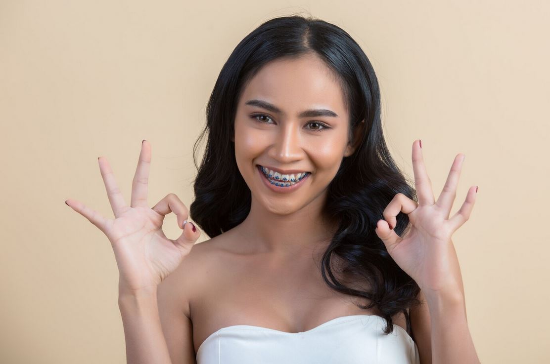 Beyond Braces: Modern Solutions for Perfecting Your Smile